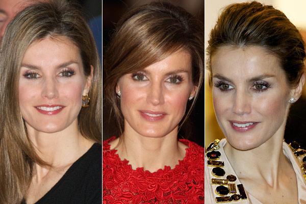 Botox: para las arrugas de expresión 